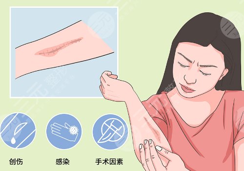 青島大學附屬醫(yī)院整形科疤痕植皮修復