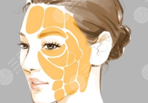 泉州第一醫(yī)院整形美容科有沒有墊額頭