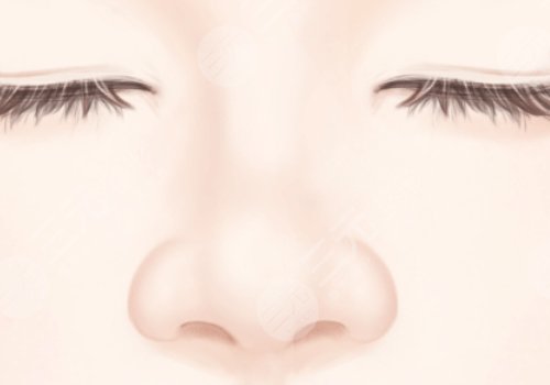 高順福,鼻整形手術,費用