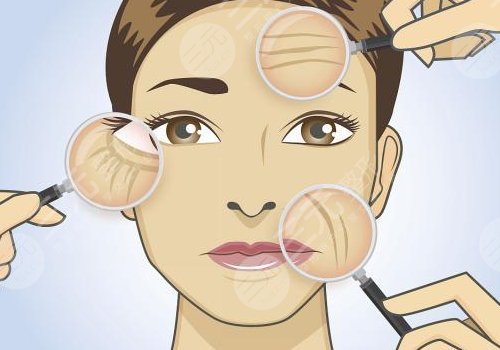 眼下干紋做什么醫(yī)美