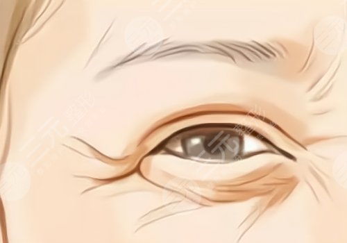 眼下干紋做什么醫(yī)美