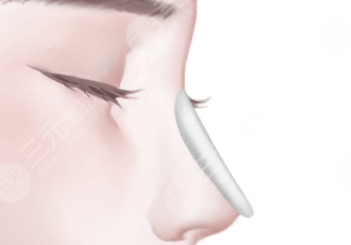 李從從做鼻子怎么樣