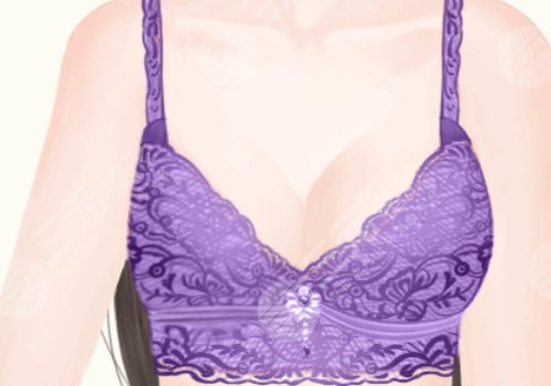 乳房填充脂肪多少錢