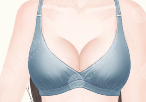 乳房填充脂肪多少錢