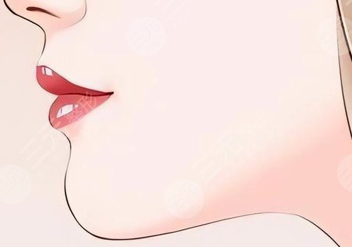 下巴整形多少錢(qián)