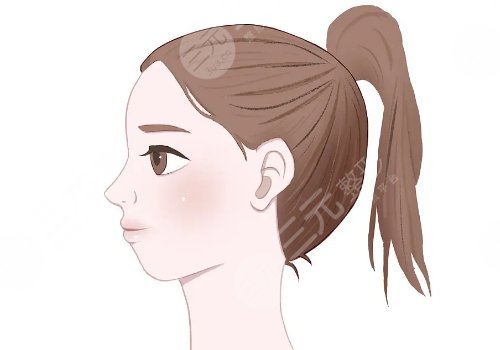 下巴整形多少錢(qián)