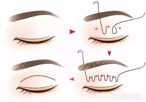 上海市第六人民醫(yī)院整形外科