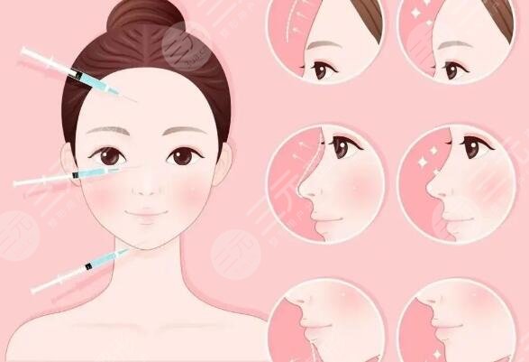 注射瘦臉