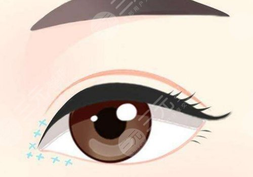 宜昌蕾帝整形醫(yī)院朱園杰怎么樣