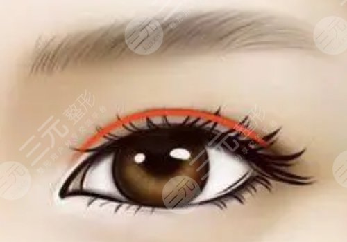 深圳陽光整形醫(yī)院怎么樣