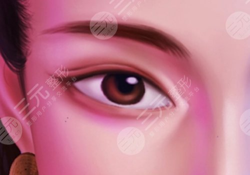 雙眼皮三個(gè)月可以修復(fù)嗎