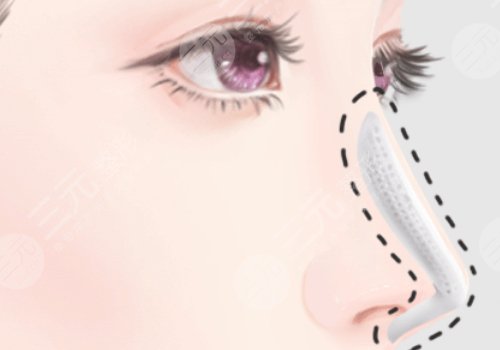 深圳陽光整形醫(yī)院是正規(guī)醫(yī)院嗎