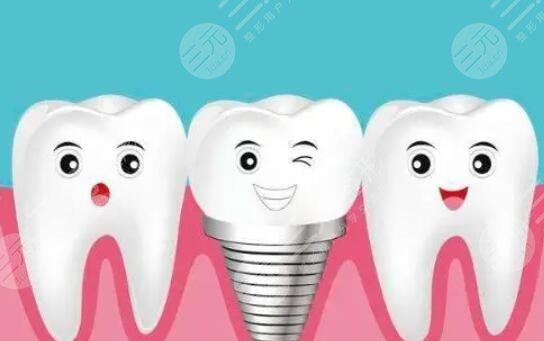 牙齒種植