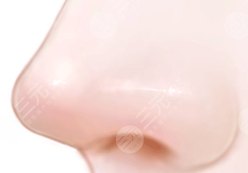 整鼻子風(fēng)險(xiǎn)大嗎