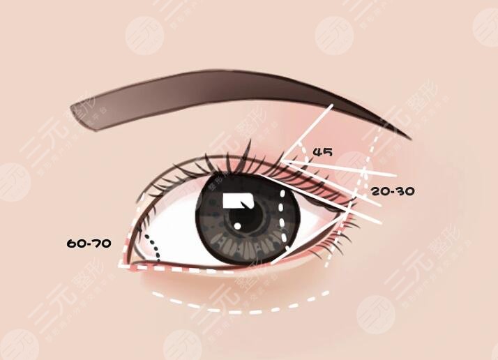 任沖醫(yī)生眼修復價格