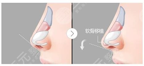 上海國(guó)際醫(yī)學(xué)中口碑點(diǎn)評(píng)