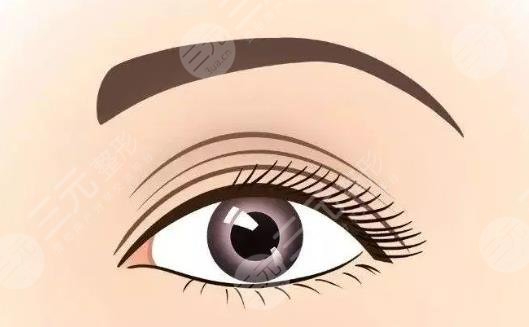 雙眼皮修復(fù)