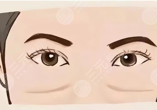 上海九院脂肪填充淚溝多少錢