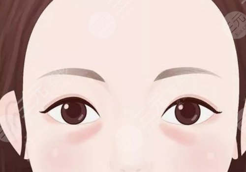 上海九院脂肪填充淚溝多少錢