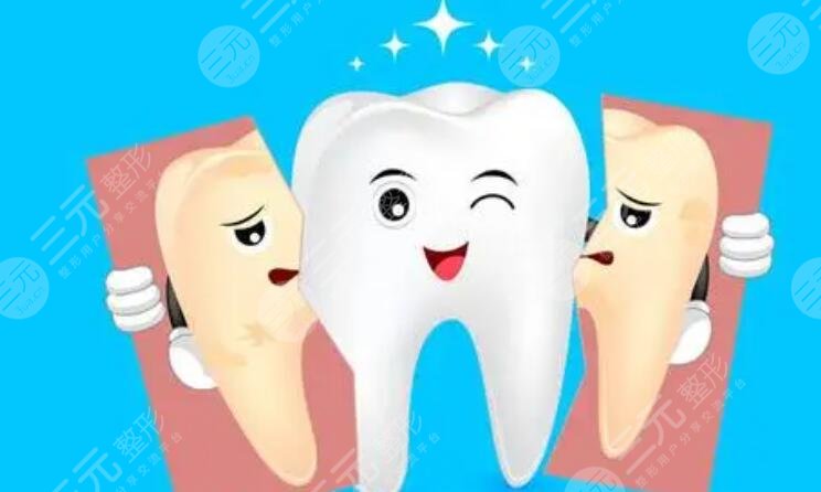 牙齒美白
