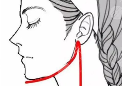 上海九院正頜手術(shù)成功率高嗎