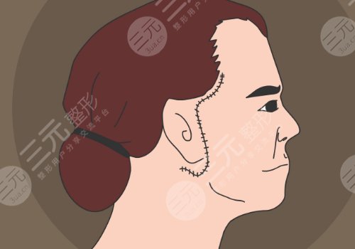 黃廣香和魏廣運(yùn)拉皮誰(shuí)更厲害