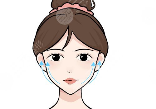 朱自剛無痕筋膜提升怎么樣