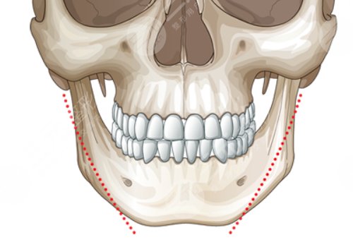 邱立東磨骨怎么樣