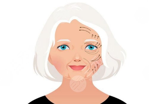 王志堅(jiān)醫(yī)生小拉皮提升做的怎么樣