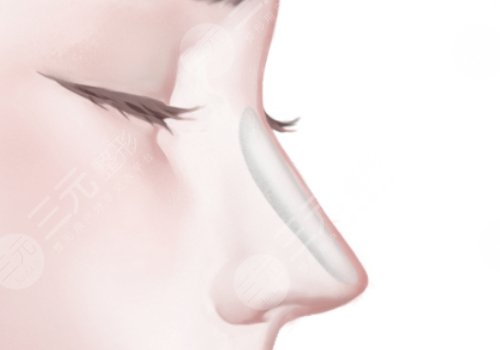 廈門周璟做的鼻子安全嗎