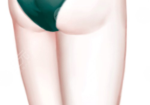 廣醫(yī)一院抽脂價(jià)格