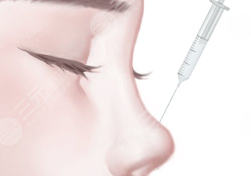 2025北京協(xié)和醫(yī)院注射隆鼻價(jià)格是多少