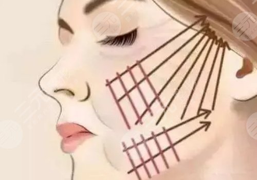 天津伊美爾做拉皮手術(shù)哪個(gè)醫(yī)生好？袁志瑋醫(yī)生值得信賴！