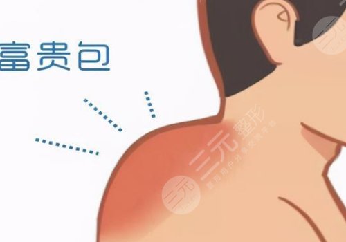 宿州市立醫(yī)院韋元強(qiáng)富貴包技術(shù)怎么樣