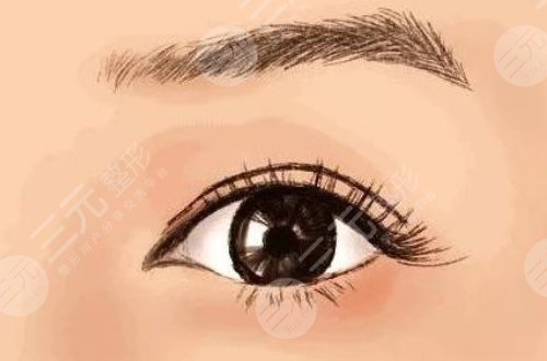 溫科磊醫(yī)生的雙眼皮手術(shù)案例