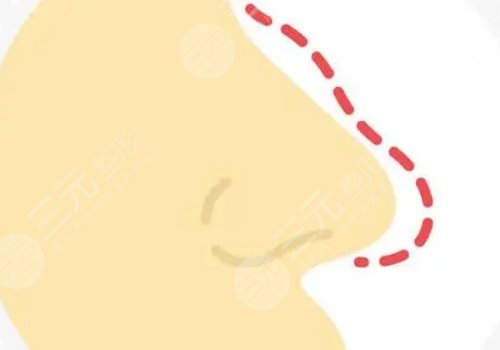 李信鋒和李勁良選哪個