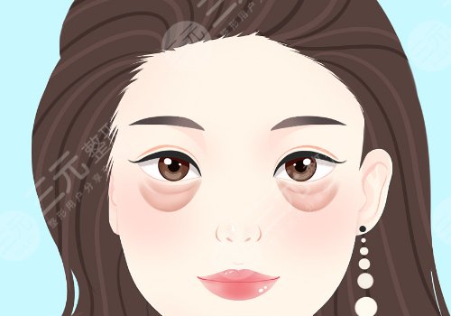 成都美萊做眼袋怎么樣