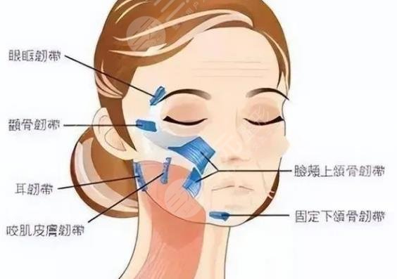 面部筋膜懸吊術