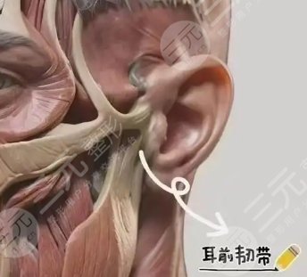 耳前韌帶提升