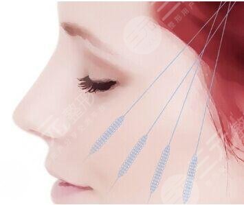 太陽(yáng)穴凹陷填充