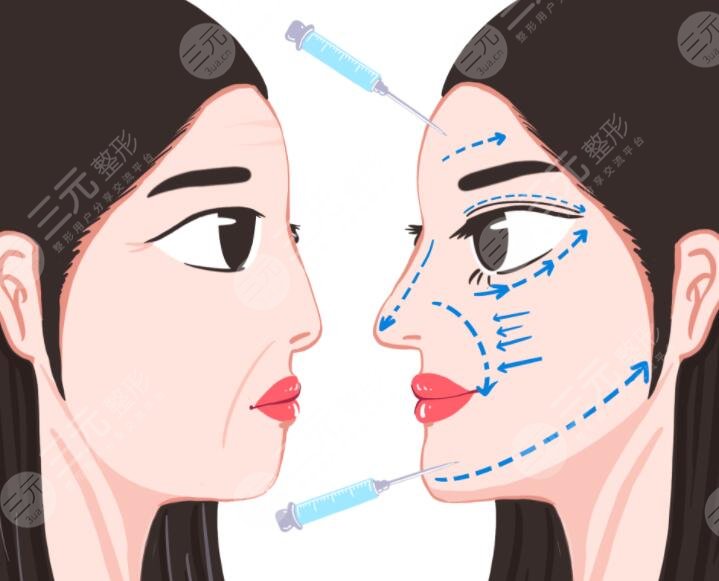 注射美容