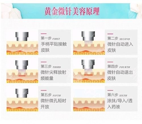 痤瘡疤痕修復(fù)、私密年輕化