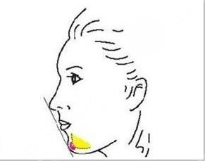 下巴微調(diào)到底多少錢?