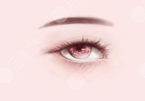 龍巖第一醫(yī)院做雙眼皮