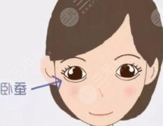 填臥蠶多久恢復(fù)？填臥蠶的恢復(fù)期更關(guān)鍵！一張表看懂