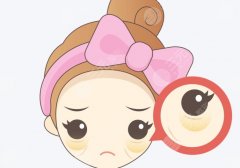 內(nèi)路祛眼袋怎樣能消腫？消腫時(shí)間表+價(jià)格區(qū)間一次講透